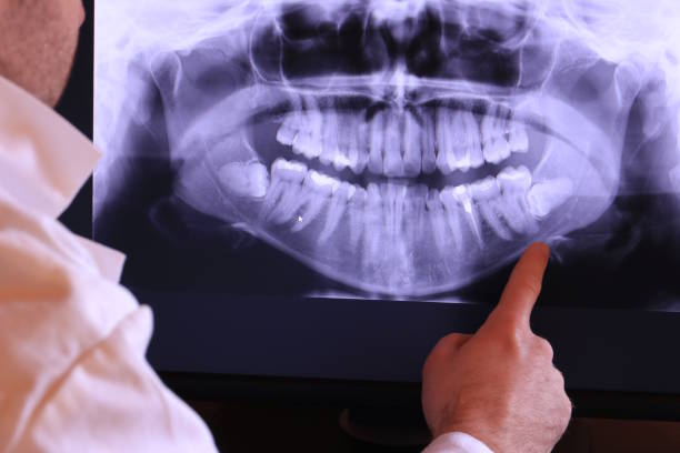 Best Emergency TMJ Treatment in Monrovia, CA