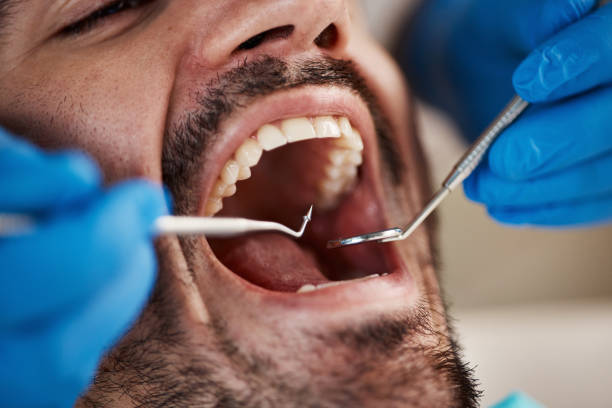 Best Emergency Dental Care for Broken or Chipped Teeth in Monrovia, CA